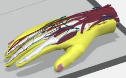 CREAFORM HandySCAN 形創(chuàng)手持式三維激光掃描儀在醫(yī)療器械行業(yè)的應(yīng)用